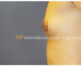 Breast surgery