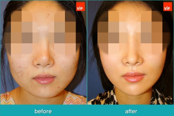 	Nose Surgery, Rib cartilage Rhinoplasty, Facial Bone Surgery	 - Face Contouring Surgery, V-line Jaw Reduction, Harmony Rhinoplasty using Rib Cartilage